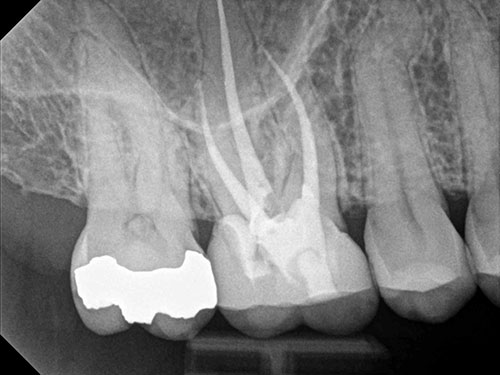 xray2